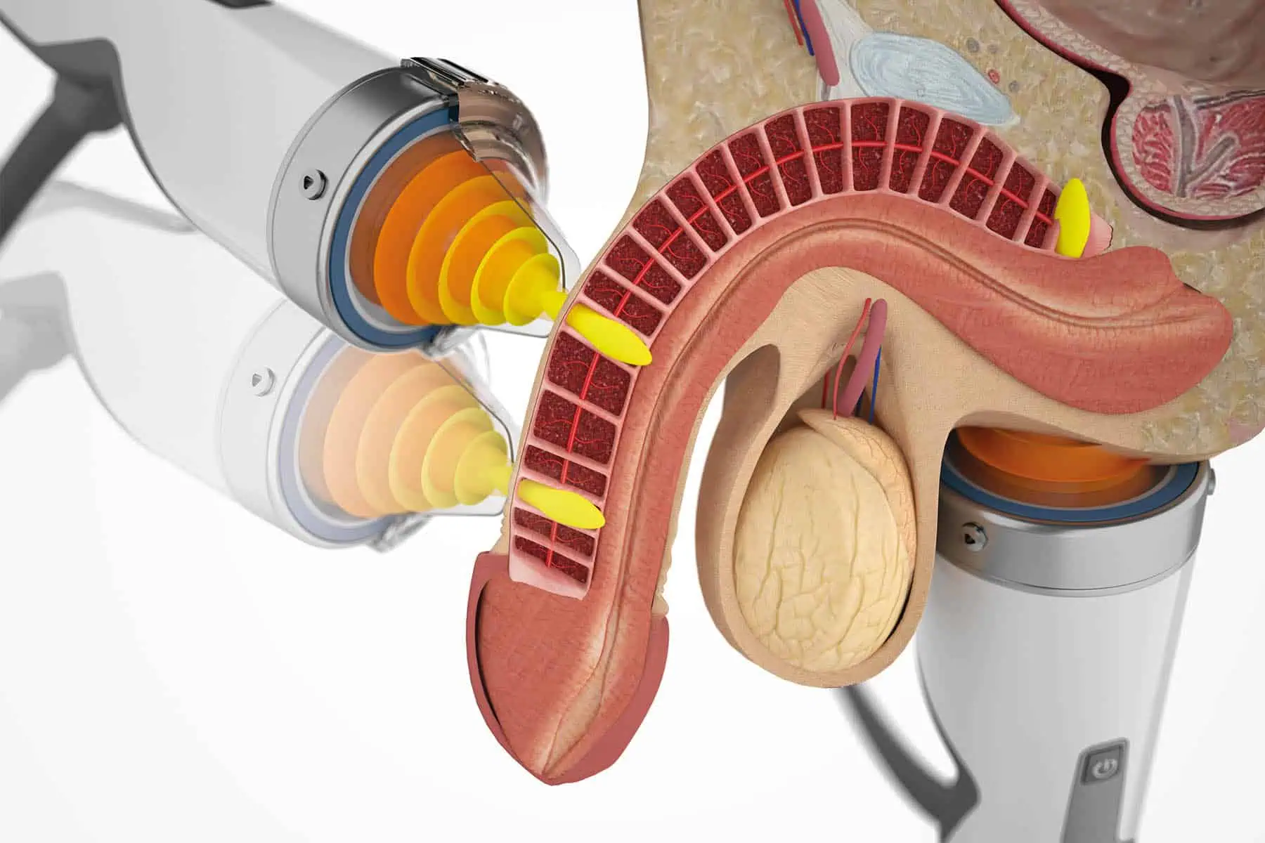 Shockwave Therapy for ED: What Men Over 40 Need to Know